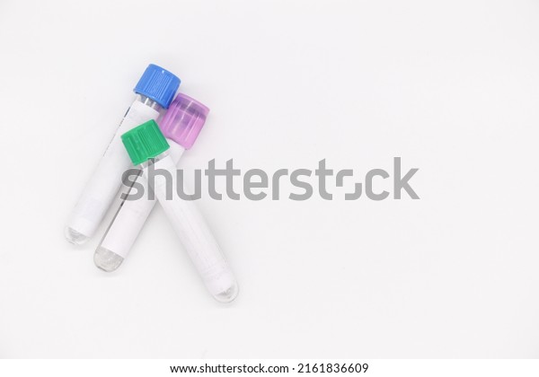 Three vacuum tubes for collection blood\
samples on white\
background