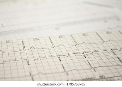 Three-channel Holter EKG Strip Showing Heartbeat Waves. Electrical Activity Of The Heart Recorded On Paper. Heart Waves Recorded In A Test.