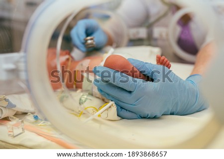 Three-day-old newborn baby in intensive care unit in a medical incubator. Macro photo of doctor's hands and legs of a child. Newborn rescue concept. The work of resuscitation doctors. Photo indoors.