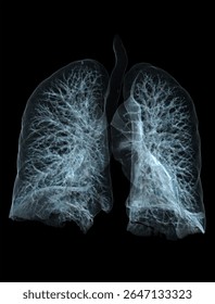 Three-dimensional computed tomography (CT) scan of the human respiratory system, showing detailed anatomy of the lungs, trachea, bronchi,
 bronchioles, and alveoli. The image provides a comprehensive 