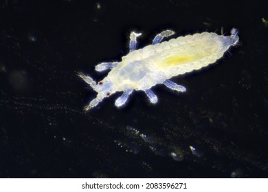 Thrip (Thysanoptera) tiny insect under light microscope.