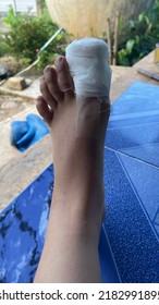 Thumb Foot Injury Nail Plate