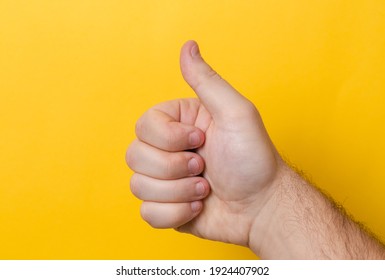 Thumbs Up Injured Or Bad Finger Nail On Yellow Background. Close Up Thumb With Bad Manicure Close Up