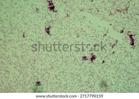 Thyphus bacteria under the microscop 400x