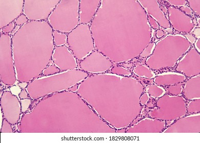 Thyroid follicles lined by a flat cuboidal epithelium and filled with eosinophilic colloid. Light microscope picture. H&E stain