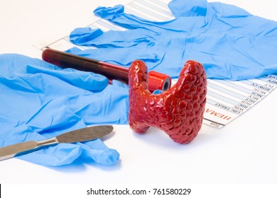 Thyroid or parathyroid gland endocrine surgery concept. Model of thyroid gland is near scalpel, surgical gloves and blood test tube with hormone result. Indications for surgery and surgical operation
