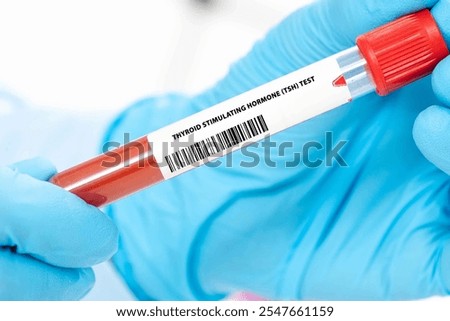Thyroid Stimulating Hormone (TSH) Test Assesses thyroid function by measuring TSH levels.
