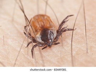 Tick feeding on human, extreme close up with high magnification, focus on tick head