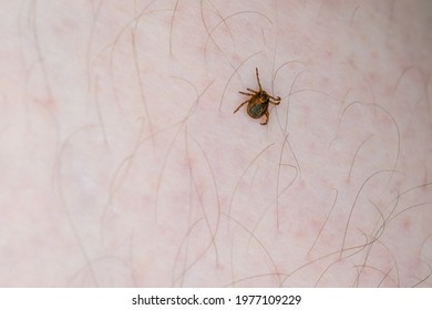 Tick On Human Body Stock Photo 1977109229 | Shutterstock