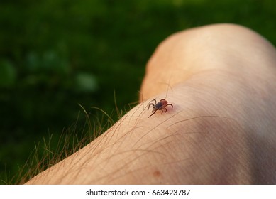 Skin Parasites >> Human Skin Parasites Images Stock Photos Vectors Skin Parasites >> Human Skin Parasites Images Stock Photos Vectors