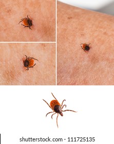 Tick on human skin and one isolated on white - Ixodida
