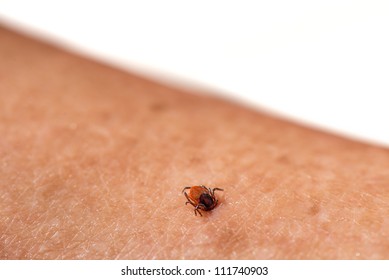 Tick on skin - Ixodida
