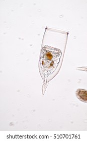Tintinnid (Marine Protozoa) under microscope
