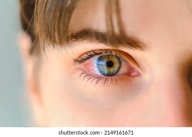 Tired eyes and contact lenses. Close up. Green eyes of a teenager inflamed and with red veins - Shutterstock ID 2149161671