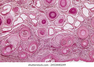 Tissue sample of Bone human, Elastic cartilage human and Red bone marrow under the microscope in Lab.