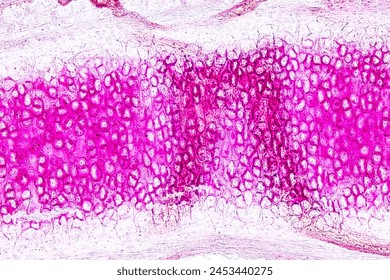 Tissue sample of Bone human, Elastic cartilage human and Red bone marrow under the microscope in Lab.