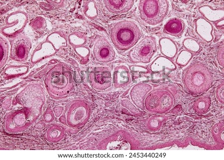 Tissue sample of Bone human, Elastic cartilage human and Red bone marrow under the microscope in Lab.