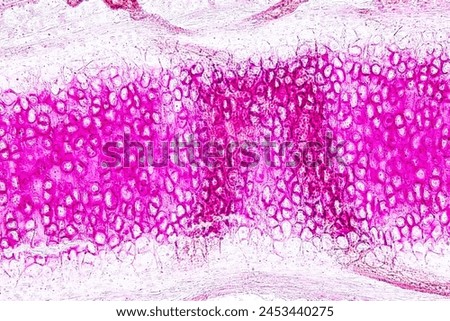 Tissue sample of Bone human, Elastic cartilage human and Red bone marrow under the microscope in Lab.