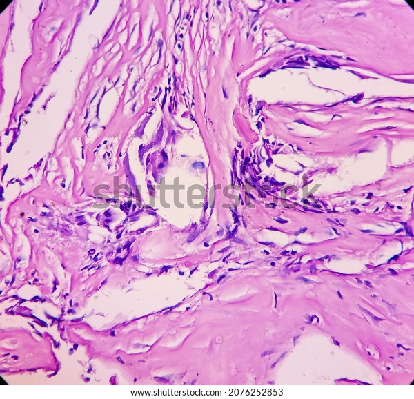 Tissue Sellar Lesion Microscopy Show Multiple Stock Photo 2076252853 ...