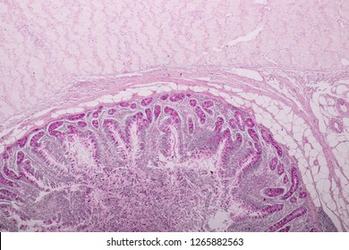 Surgical Pathology Show Section Subtotal Colectomy Stock Photo (Edit ...