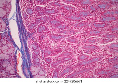 Tissue of Small intestine (Duodenum), Large intestine Human and Stomach Human under the microscope in Lab.