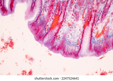 Tissue of Small intestine (Duodenum), Large intestine Human and Stomach Human under the microscope in Lab. - Shutterstock ID 2247524641