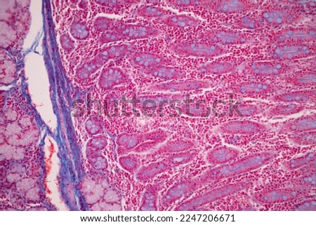 Tissue of Small intestine (Duodenum), Large intestine Human and Stomach Human under the microscope in Lab.