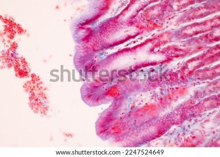 Tissue of Small intestine (Duodenum), Large intestine Human and Stomach Human under the microscope in Lab.