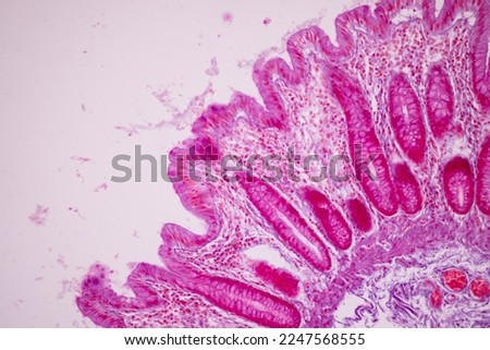 Tissue of Small intestine (Duodenum), Large intestine Human and Stomach Human under the microscope in Lab.
