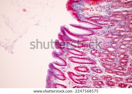 Tissue of Small intestine (Duodenum), Large intestine Human and Stomach Human under the microscope in Lab.