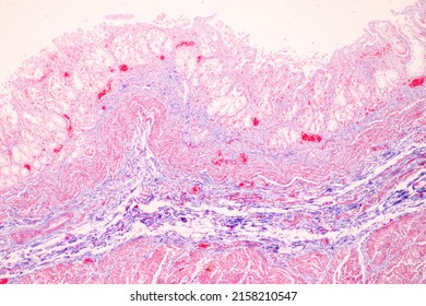 8,233 Stomach tissues Images, Stock Photos & Vectors | Shutterstock