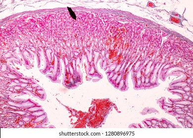 Columnar Epithelium Images, Stock Photos & Vectors | Shutterstock