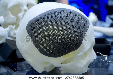Titanium cranioplates. Prototype of human skull from white plastic with individual patient-specific cranial plate grid made of biocompatible titanium printed on 3D printer. Bioengineering implant