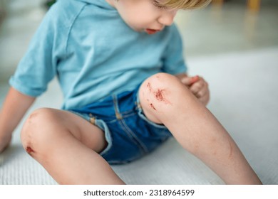 Toddler boy with sore scraped knees. Parent helping her child perform first aid knee injury after he has been an accident.