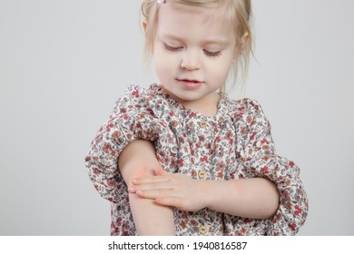 Toddler Girl Suffering From Atopic Dermatitis, Close Up Image. Red And Itchy Skin. Eczema On Kid's Arm.