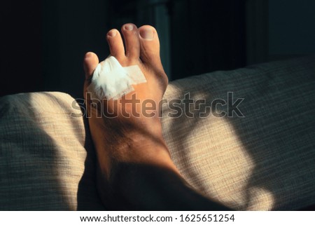 The toe is disabled, leaving only four toes. One toe is cut off. Causes of skin diseases that spread deep to the bones.