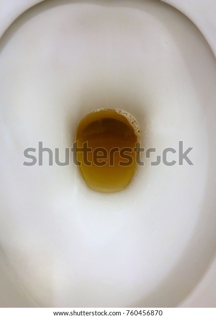 Toilet Seat Urine Dark Yellow Urin