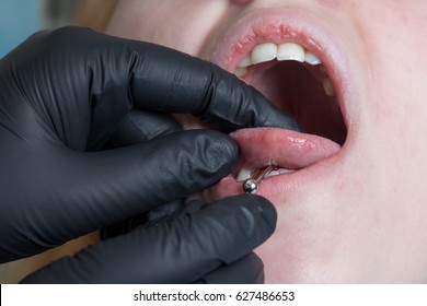 Tongue Piercing Operation