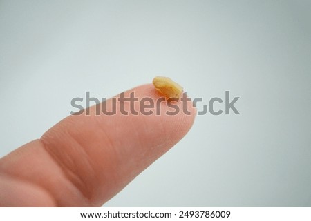 tonsil stone close up on white background - tonsil stones on finger close up