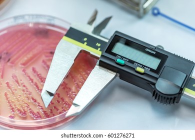 The Tools for measuring zone size of bacteria as sub sensitivity test for laboratory in the hospital; Escherichia coli colonies on media plate bacteria culture growth.