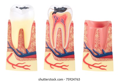 Tooth Anatomy Collection (vital Tooth, Structure, Bone, Ligament And Socket) Isolated On White Background