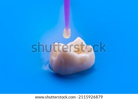 tooth bonding before starting the filling