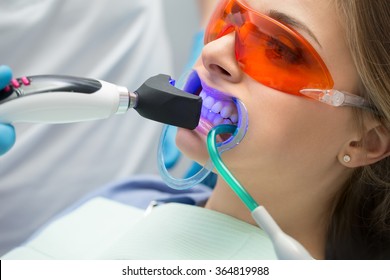 Tooth filling ultraviolet lamp - Shutterstock ID 364819988