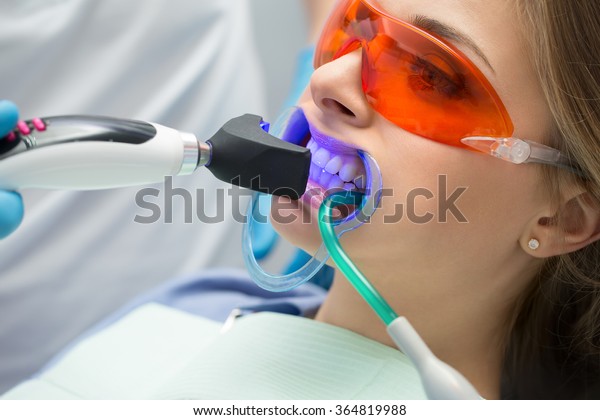 Tooth filling ultraviolet\
lamp