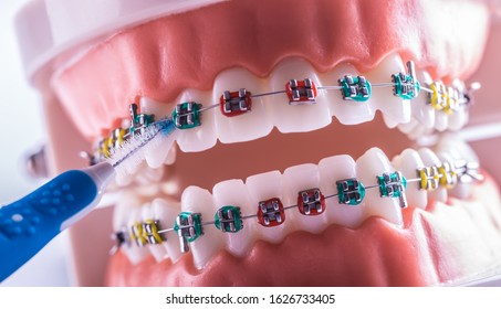 Tooth Model From Dental Braces With Inter Dental Teeth Cleaning Brush.