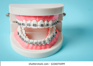 Tooth Model Metal Wire Dental Braces Stock Photo 1226074399 | Shutterstock