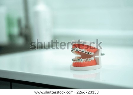 tooth model with metal wire dental braces, dental tooth dentistry.