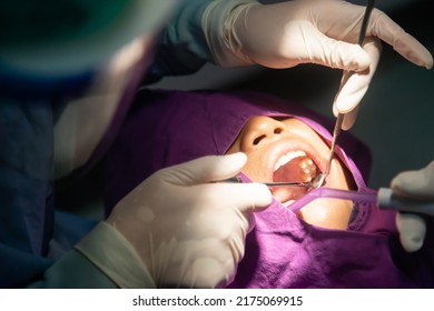 Tooth removal . Dental, dentists, dental laboratories in low light conditions. Oral health and teeth. - Shutterstock ID 2175069915