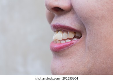 97 Skewed mouth Images, Stock Photos & Vectors | Shutterstock