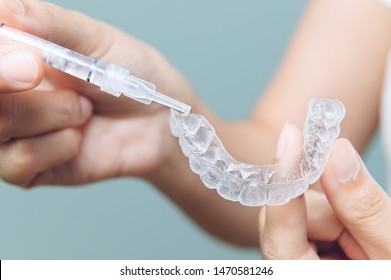 Tooth whitening gel being applied to a tooth mold in preparation for being placed in the mouth. - Shutterstock ID 1470581246